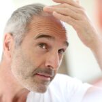 August is National Hair Loss Awareness Month