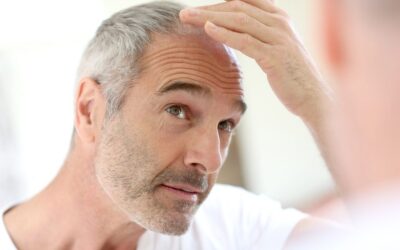 August is National Hair Loss Awareness Month