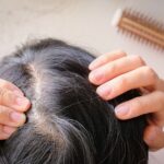 Medical Hair loss and the effects of Chemotherapy on the Scalp – 06/10/2021