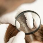 Why am I experiencing Hair Loss? – 05/07/2021