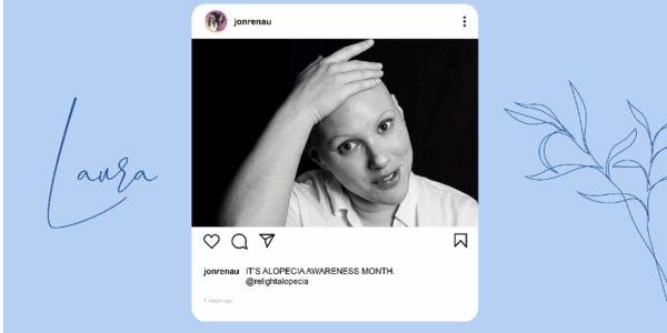 Real Stories from Alopecia Clients