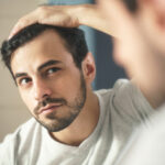 7 Stages of Hair Loss – The Norwood Scale