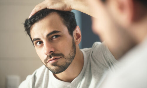 7 Stages of Hair Loss – The Norwood Scale