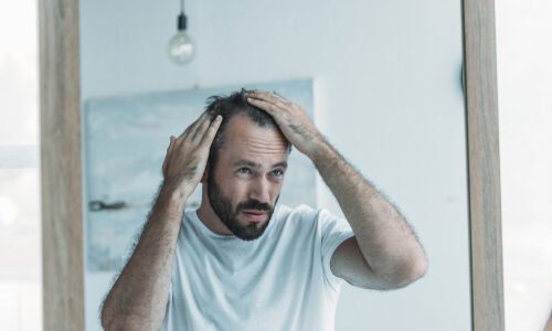 How much hair loss is normal