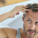 Hair loss after weight loss: What is the connection?